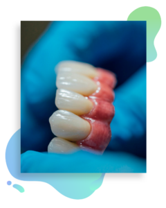 Prótesis dentales en Badajoz