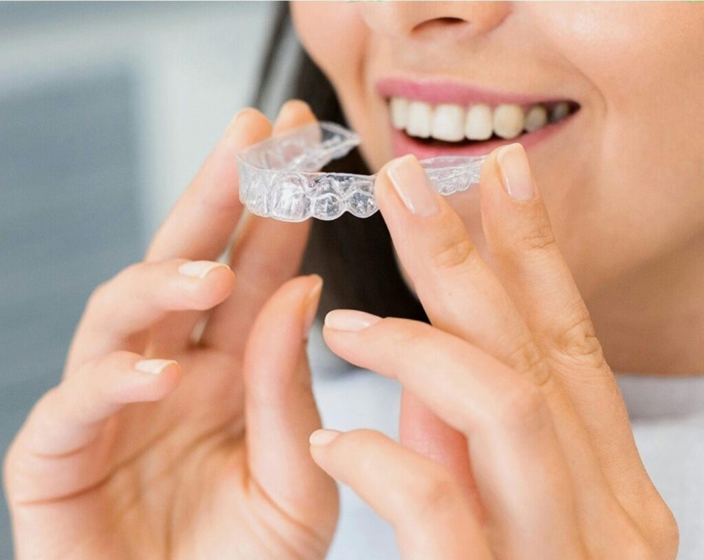 beneficios del invisalign
