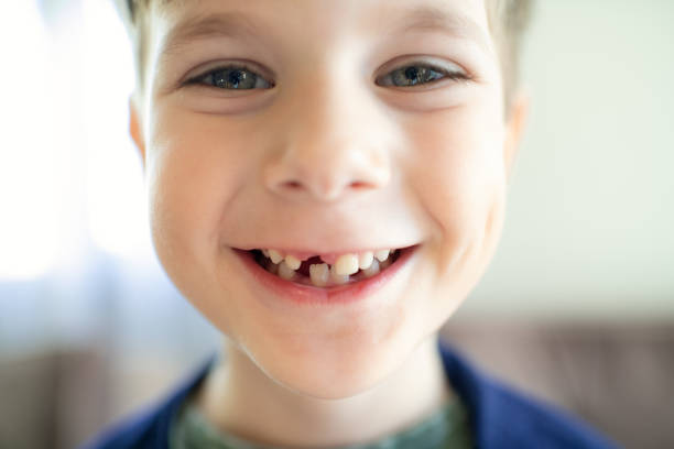 Extracción de dientes de leche