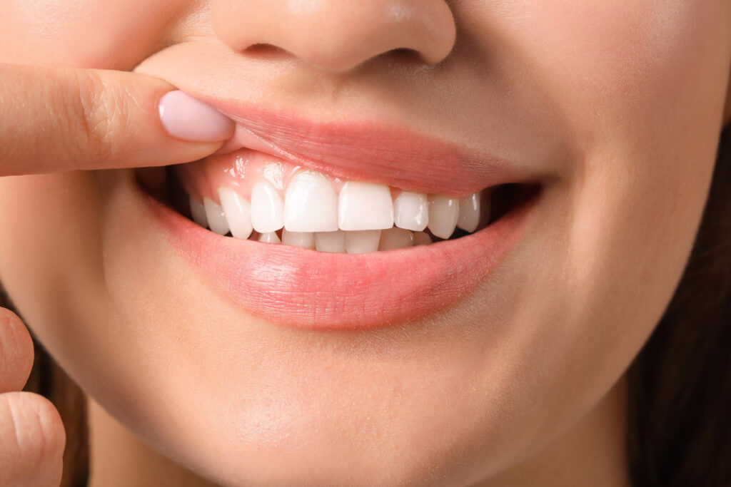 periodoncia en Badajoz